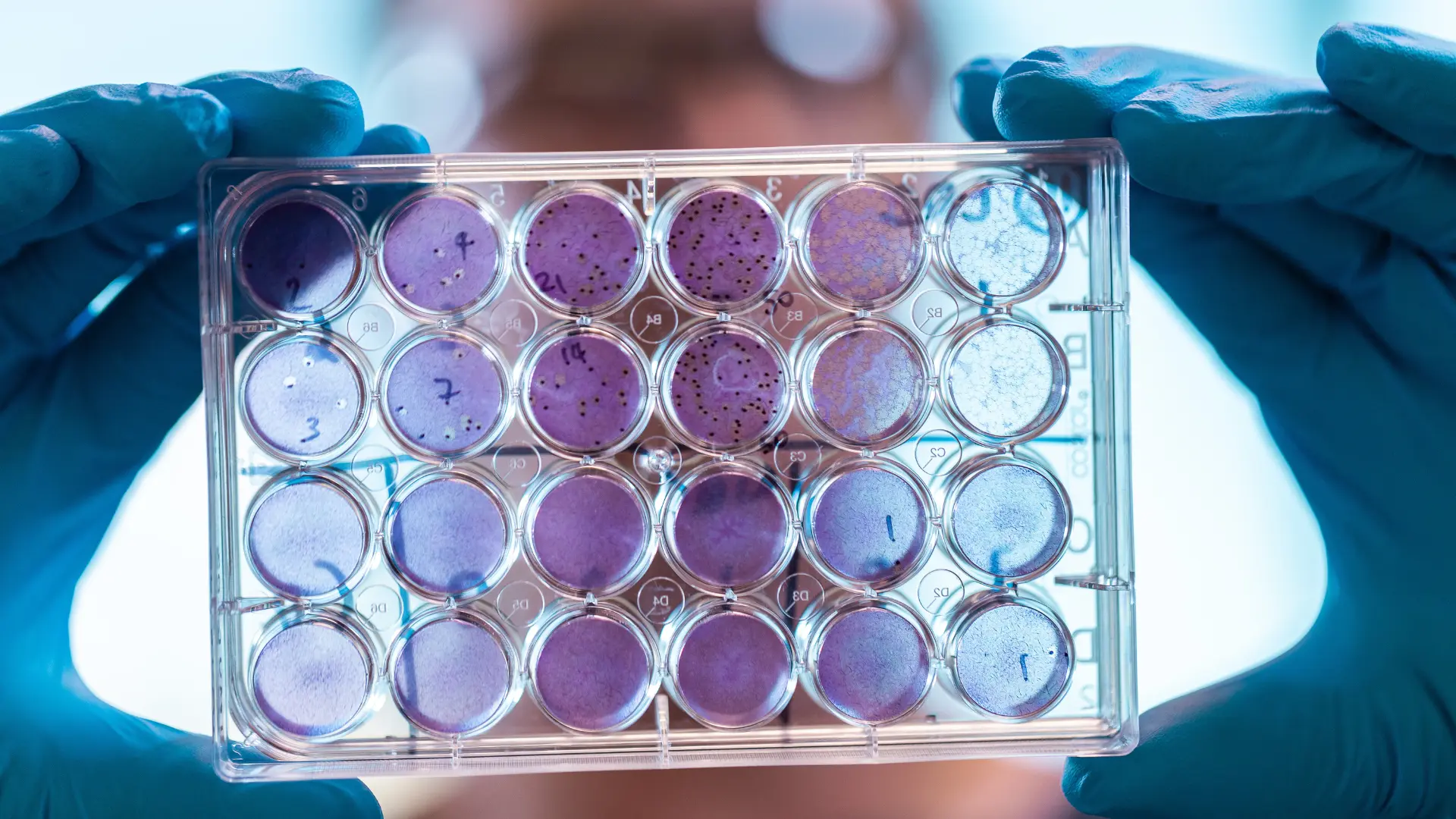 Cell plate vaccine and virology